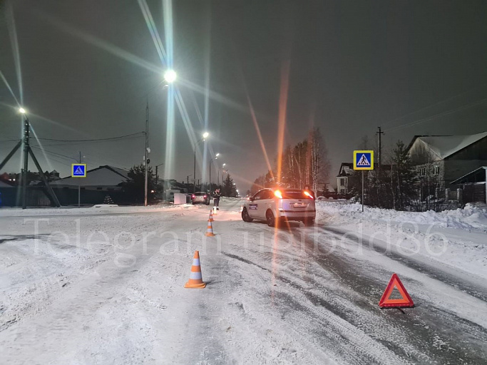 Водитель иномарки сбил ребенка на пешеходном переходе в Югре